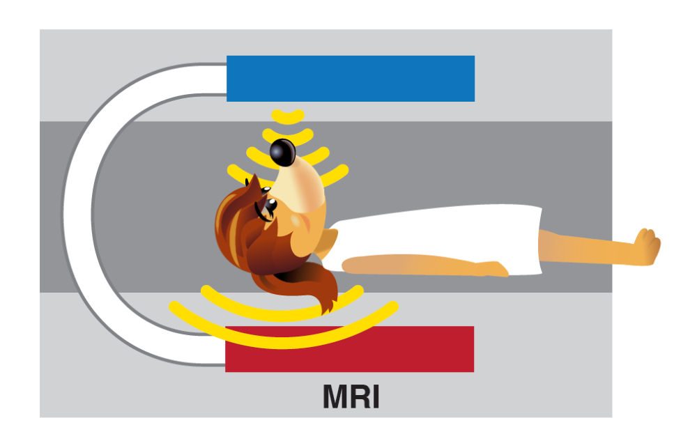 Simplified diagram of a patient in an MRI machine.