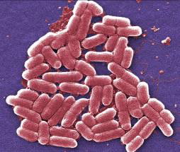 Microscopic image of e. coli cells