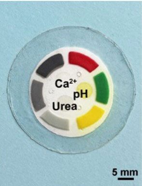 A circular object with a clear outer edge and a white inner circle bordered with six colorful rectangles. The inside of the white circle contains the words urea, pH and Ca2+. A five-millimeter scale bar is in the lower right-hand corner.  